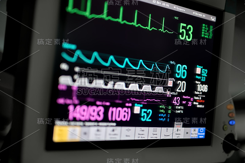 心电图监测器的微距照片