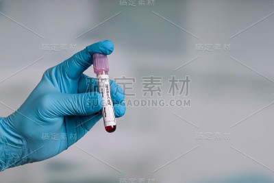 医生手持医用手套的手拿着血液探针检查冠状病毒