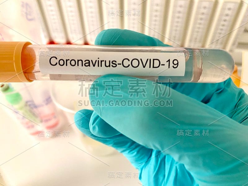 冠状病毒Sars-CoV-2测试