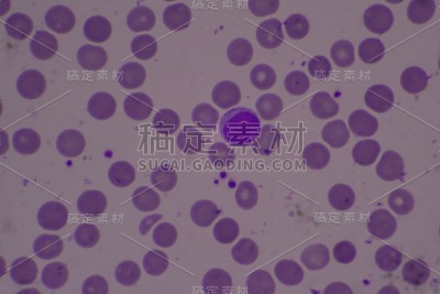 血液涂片中血小板充足，血细胞计数完整。