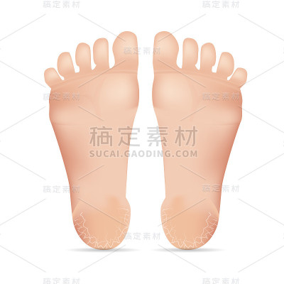 龟裂的高跟鞋在白色背景矢量插图。