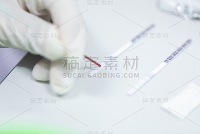 实验室乙型肝炎检测的研究。