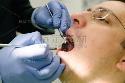 仔细检查患者的口腔。