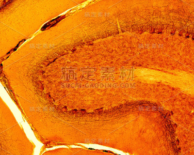 小脑皮质。硝酸银