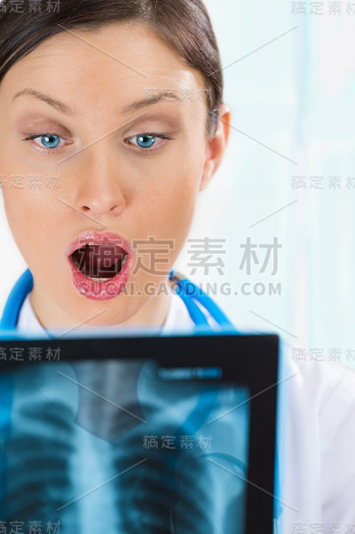 非常惊讶和兴奋的女医生在看肺部x光片