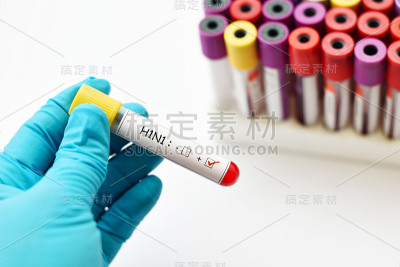 甲型H1N1流感阳性