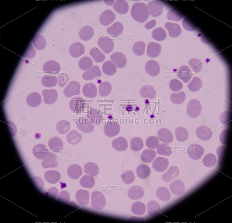 血细胞医学背景