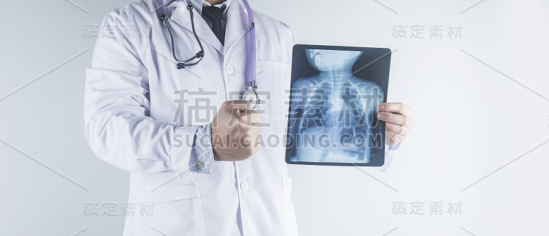 医生在医院检查病人的胸部x光片。