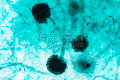 曲霉(霉菌)在显微镜下进行教育。
