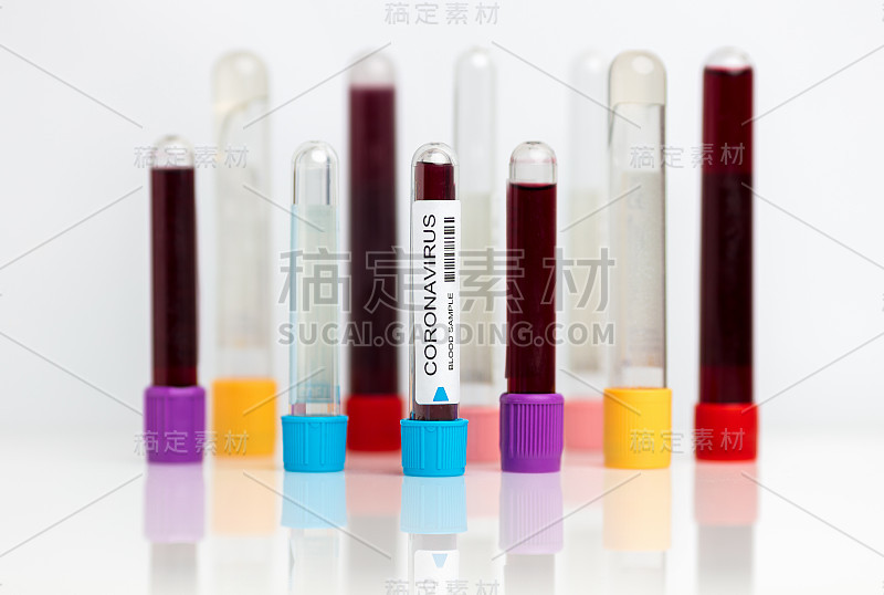 新型冠状病毒实验室样本