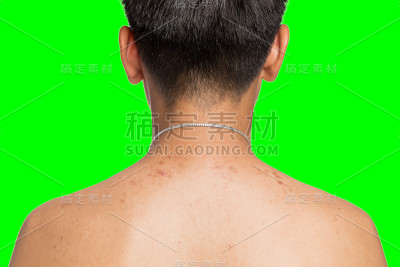 背部丘疹身体上孤立的绿色色度关键背景。