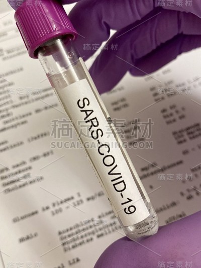 Sars-Covid-19实验室的论文