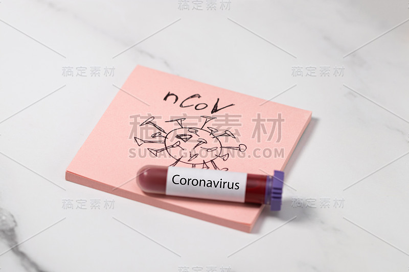 test tube with blood for 2019-nCoV analyzing. COVI