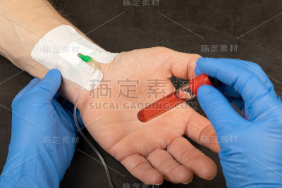 血液样本
