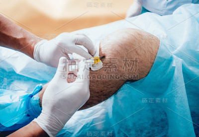 膝盖注射富含血小板的血浆