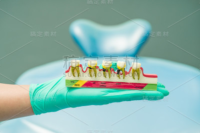 牙科医生手持牙科模型在牙科诊所