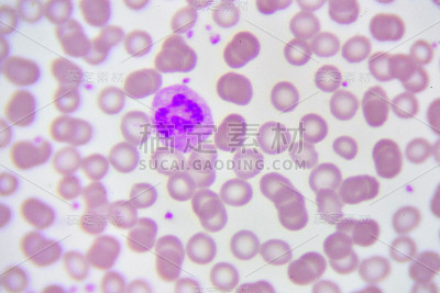中性粒细胞胞