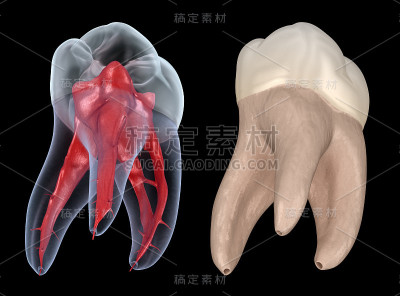 牙根解剖学-上颌第一磨牙。医学上准确的牙科3D插图