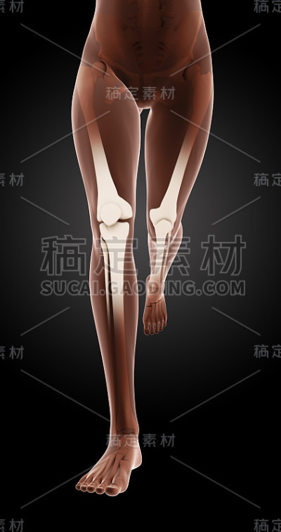 女性医用骨腿