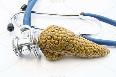用听诊器建立胰腺解剖模型，在白色背景上进行测试。胰腺炎、糖尿病、癌症等胰脏疾病的诊断、治疗、预防和饮