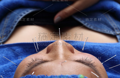 近手进行医学专业针灸治疗