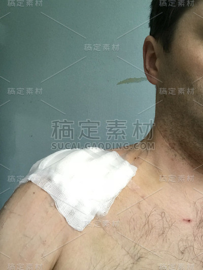纱布沾了血。在病人的锁骨手术后附着在肩膀上。