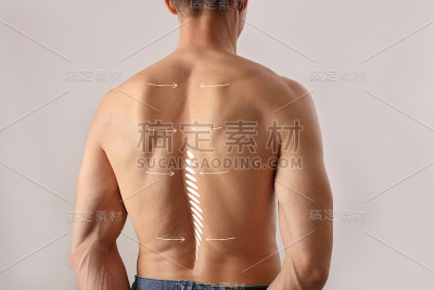 脊柱侧弯解剖学，姿势矫正。缓解背痛概念