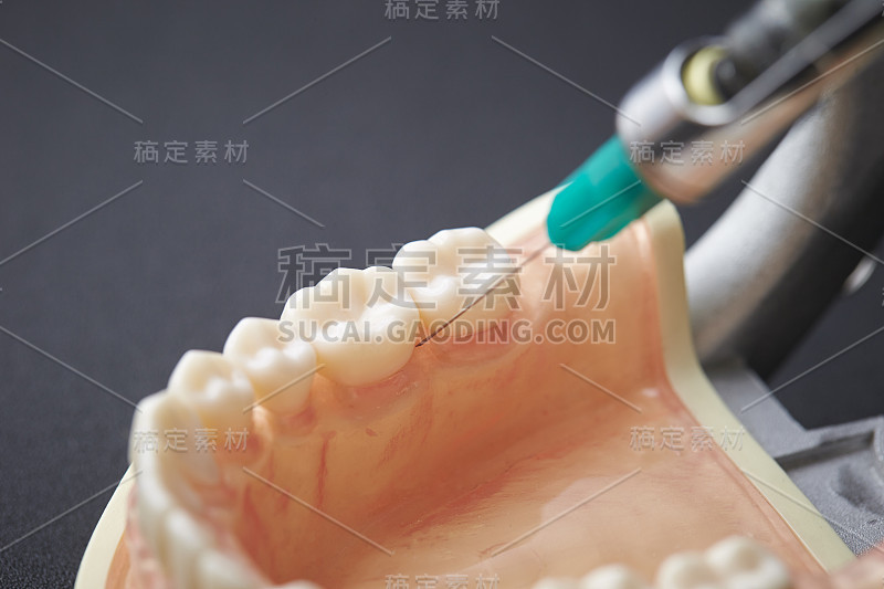 牙医的医疗设备