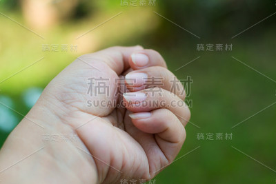 手