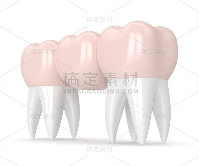 牙桥与牙冠的3d渲染