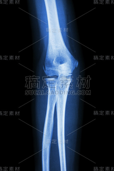 人的手肘