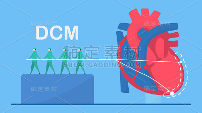 心脏病矢量插图。这种疾病叫做扩张性心肌病。血液泵送能力下降。左心室心室室变大变弱。扁平微型元件EPS