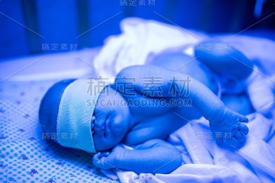 新生儿在家中床上接受紫外线灯治疗黄疸