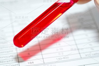 完整的血液样本和血液检测结果。健康和医学概念