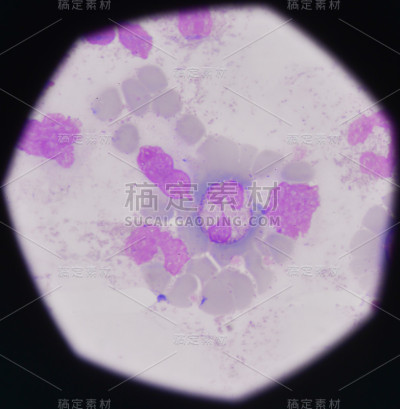 血液涂片医学背景