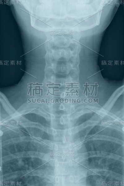 颈部X射线