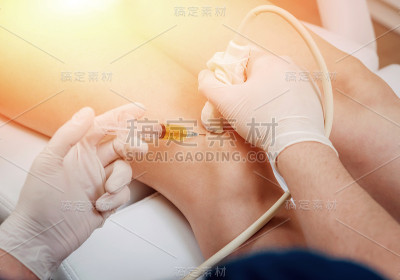超声引导下富血小板血浆注射