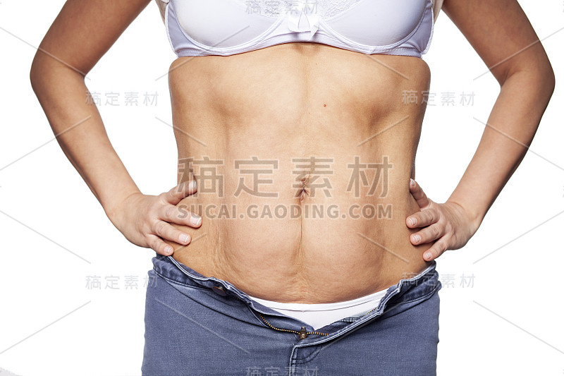 40岁女性高腹型肥胖