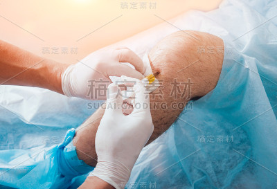 膝盖注射富含血小板的血浆