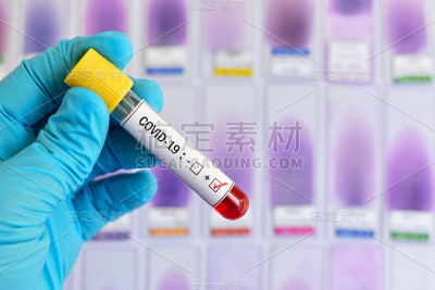 血液样管呈COVID-19病毒阳性