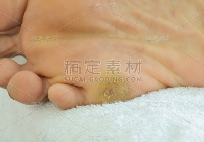 老女人的脚底