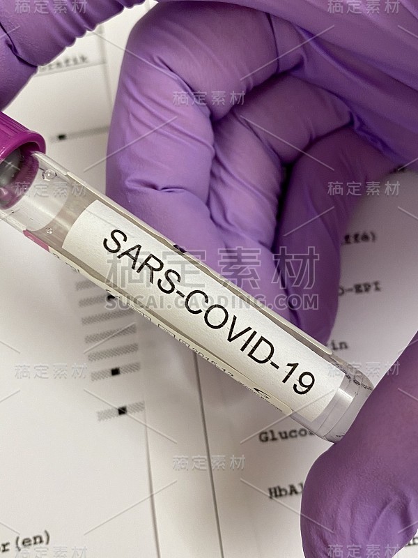 Sars-Covid-19实验室的论文