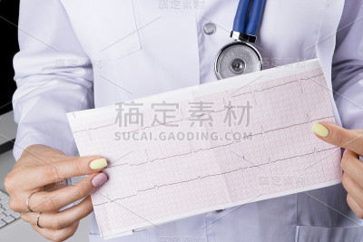 心电图，一名女医生的心电图。医疗卫生保健。临床心内科心律和脉搏检查特写。心电图打印输出。