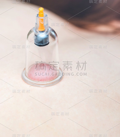 背面是真空罐。