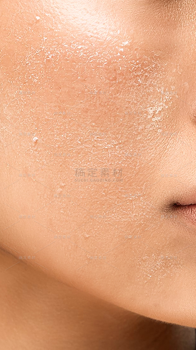 美妆系列写实风人体脸部皮肤爆皮