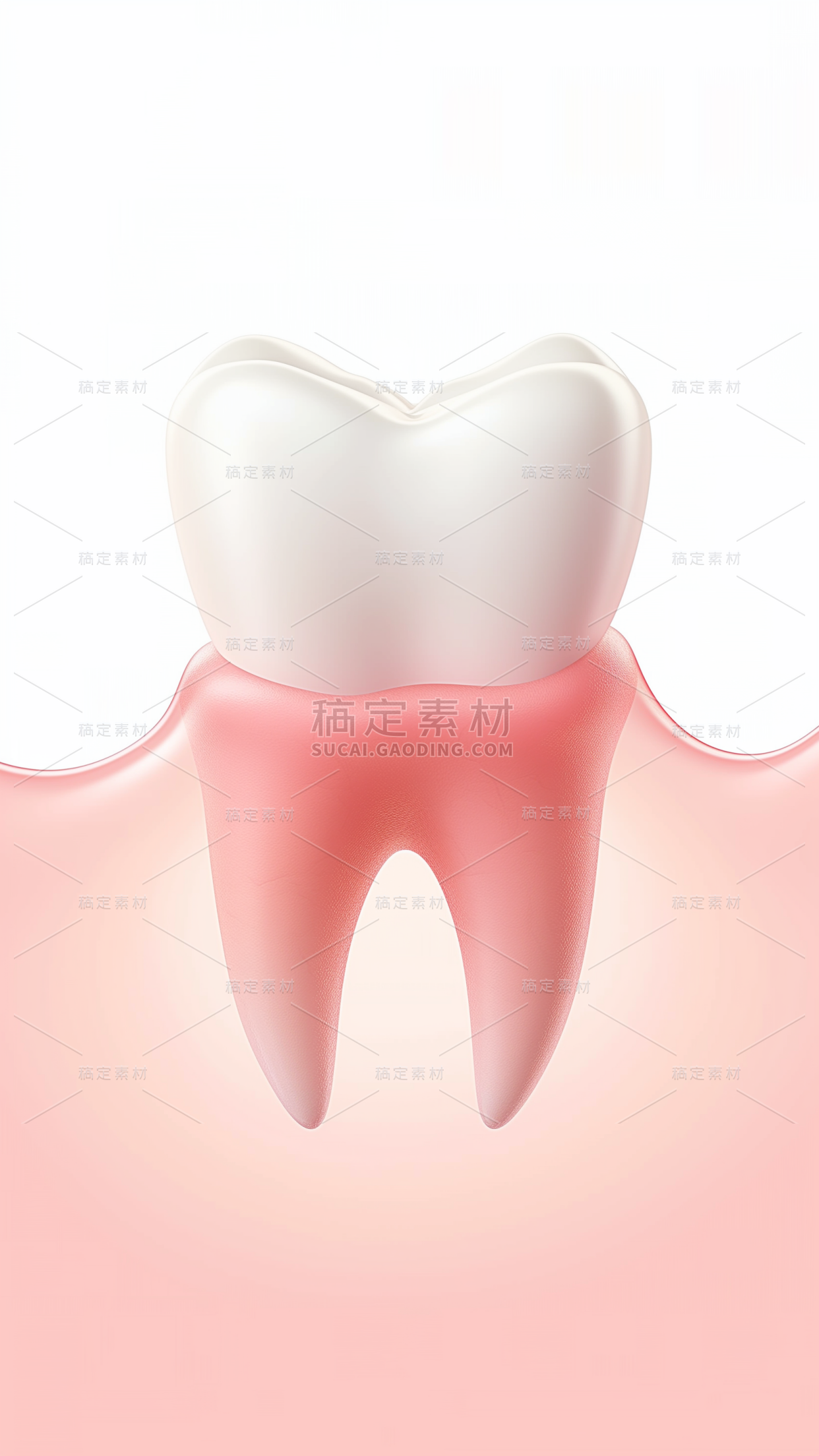 医疗系列3D牙齿牙龈发炎