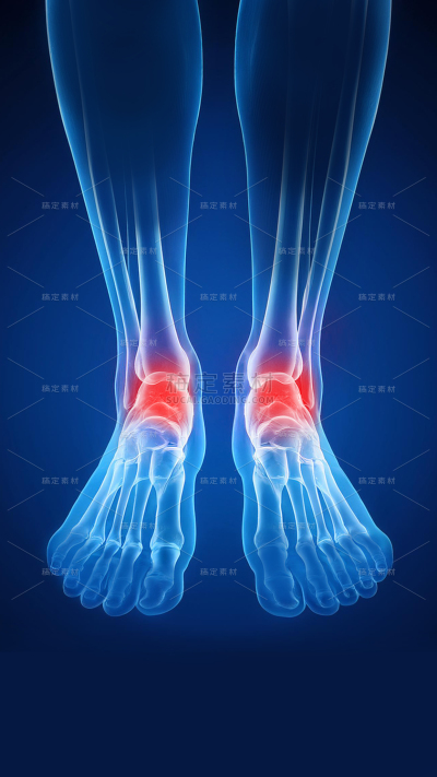 医疗系列3D科技感脚关节疼痛局部示意图