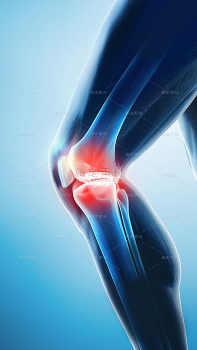 医疗系列3D科技感腿部关节疼痛局部示意图