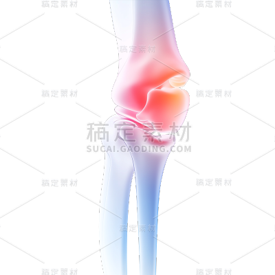 常规系列通用3D关节疼痛元素素材