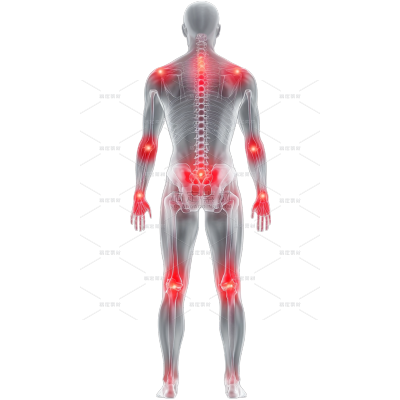 医疗系列3D人体多关节疼痛示意